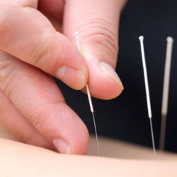 2 acupuncture therapy nyc