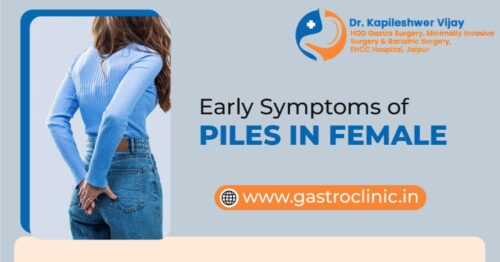 Early Symptoms of Piles in Females Early Symptoms of Piles in Females
