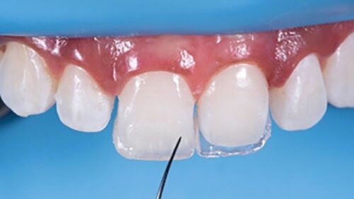 compositiondentist compositiondentist