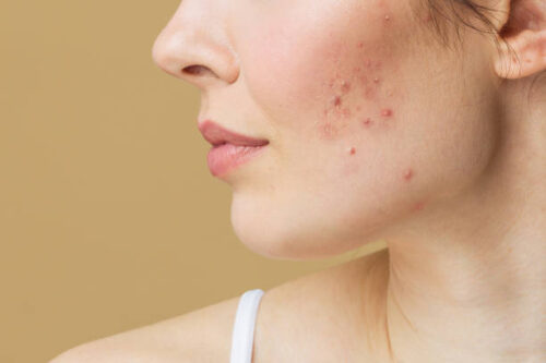 Skin Care Clinic Maple Ridge Skin Care Clinic Maple Ridge