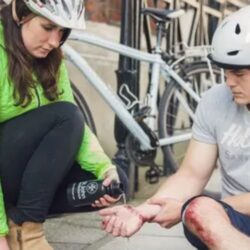 Common Cycling Injuries in Pasadena – What Riders Need to Know