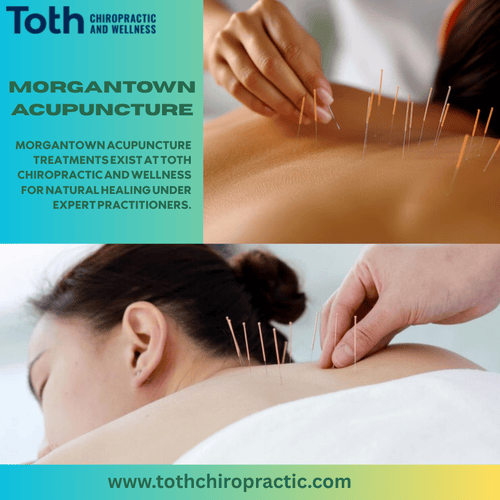 morgantown acupuncture (1) morgantown acupuncture (1)
