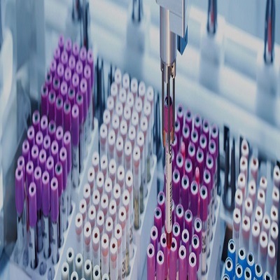 Sample-preparation-for-large-scale-testing Sample-preparation-for-large-scale-testing