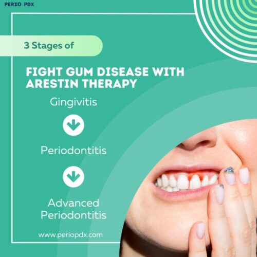 Arestin Treatment Arestin Treatment