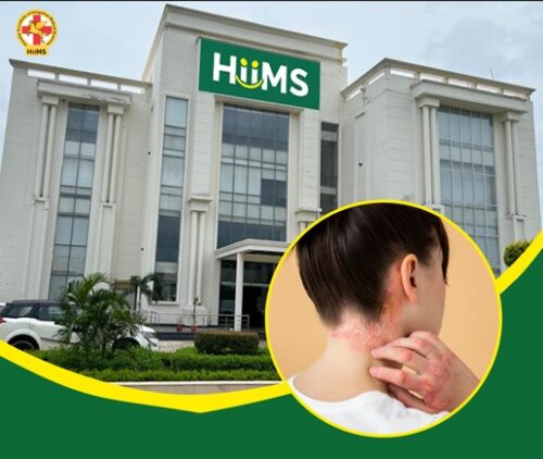 Natural Eczema Care at Top Ayurvedic Hospital Panchkula Natural Eczema Care at Top Ayurvedic Hospital Panchkula