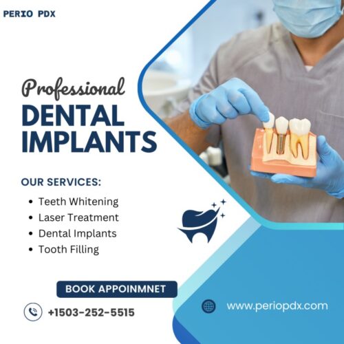 Dental Implant Placement Procedure Dental Implant Placement Procedure