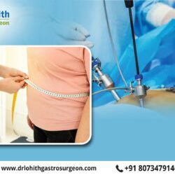 Bariatric Surgery
