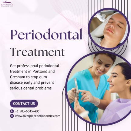 Periodontal Treatment Periodontal Treatment