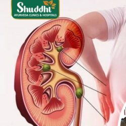 Ayurvedic Treatment for Kidney Failure in Hajipur