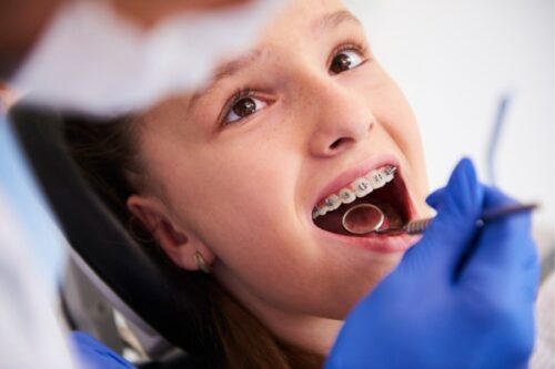Braces Treatment Braces Treatment