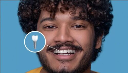 dental implants treatment. dental implants treatment.