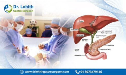 Gall bladder cancer surgery Gall bladder cancer surgery