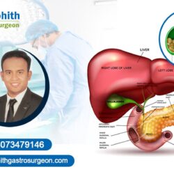 Best Gall Bladder Surgeon