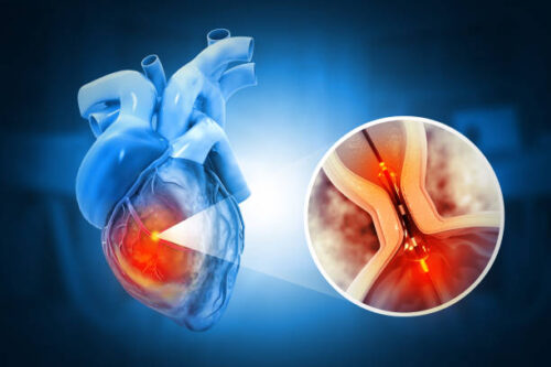 istockphoto-2192792878-612x612 istockphoto-2192792878-612x612