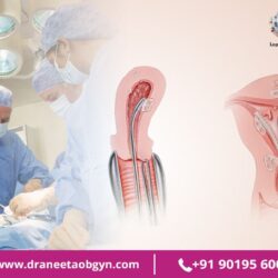 Septal Resection Specialist