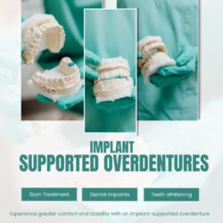 Implant-Supported Overdentures