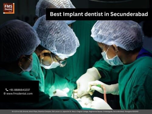 Best Implant dentist in Secunderabad Best Implant dentist in Secunderabad