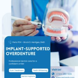 Implant-Supported Overdenture