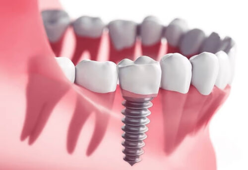 best dental best dental