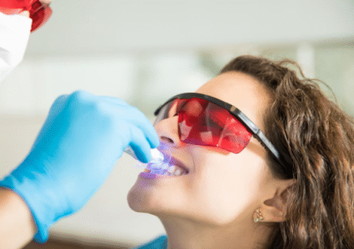 Ottawa’s Top-Recommended Teeth Whitening Solutions Ottawa’s Top-Recommended Teeth Whitening Solutions