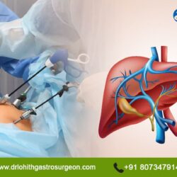 Laparoscopic Liver surgeon in Sarjapur road