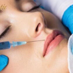 Beauty with Lip Fillers Riverside
