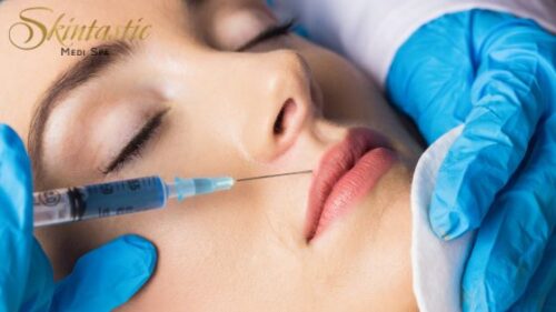 Beauty with Lip Fillers Riverside Beauty with Lip Fillers Riverside