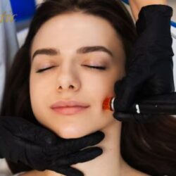 Best Hydrafacial in Riverside for Healthy Skin