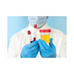 Best Doctor for Urine Infection in Delhi