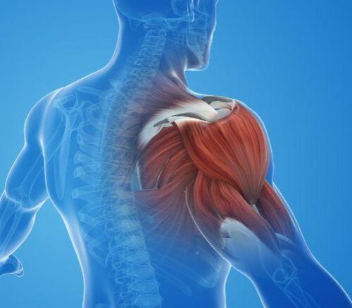 Shoulder Impingement in Gurgaon Shoulder Impingement in Gurgaon