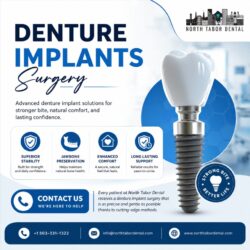 Denture implants surgery