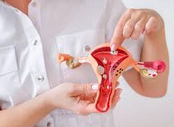 FIBROIDD