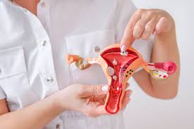 FIBROIDD FIBROIDD