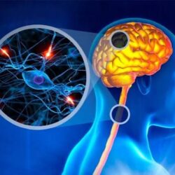 Multiple Sclerosis Treatment