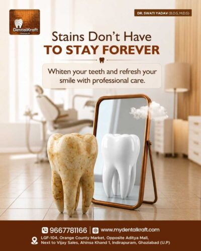 TeethCleaninginIndirapuram1 TeethCleaninginIndirapuram1