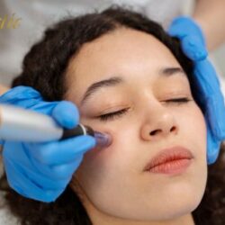 Potenza Microneedling