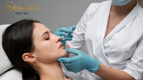 Lip Fillers Riverside for Lasting Lip Volume Lip Fillers Riverside for Lasting Lip Volume