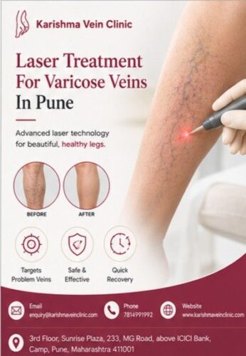 Laser Treatment For Varicose Veins In Pune - Karishma Vein Clinic Laser Treatment For Varicose Veins In Pune - Karishma Vein Clinic