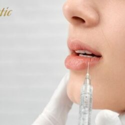 Lip Fillers CA