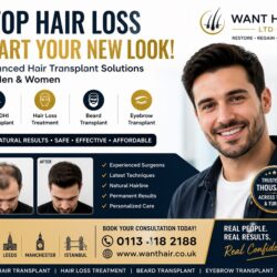 UK Hair Transplant Experts