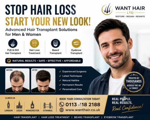 UK Hair Transplant Experts UK Hair Transplant Experts