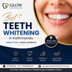 Best Teeth Whitening in Kathmandu for Brighter Smiles (1)