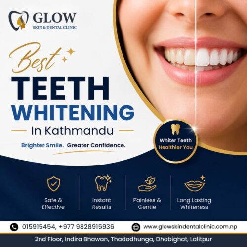 Best Teeth Whitening in Kathmandu for Brighter Smiles (1) Best Teeth Whitening in Kathmandu for Brighter Smiles (1)