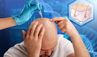 hair transplant clinic hair transplant clinic