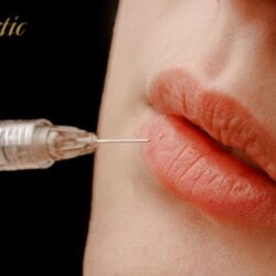 Lip Fillers Riverside for Fuller and Softer Lips