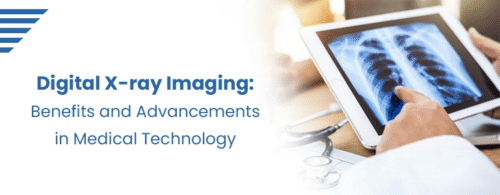 digital-x-ray-imaging-benefits-advancements-medical-technology digital-x-ray-imaging-benefits-advancements-medical-technology