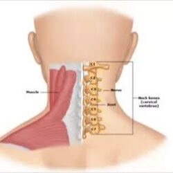 Cervical Spondylosis Treatment