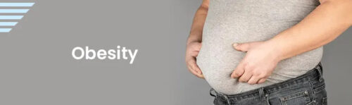 obesity obesity