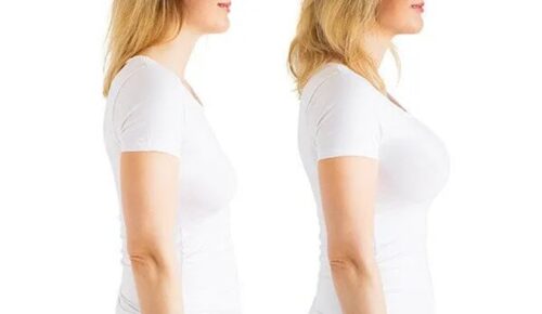 Breast surgry Dubai Breast surgry Dubai