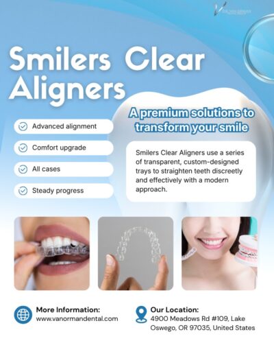 Smilers Clear Aligners for Straighten Teeth Smilers Clear Aligners for Straighten Teeth